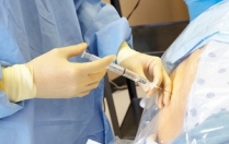 Що таке епідуральна анестезія при пологах і чи варто її робити