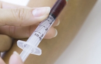 Що означає підвищений білірубін у крові під час вагітності