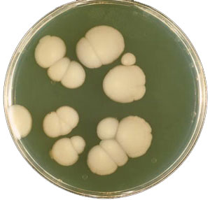 Чим небезпечний кандидоз під час вагітності?