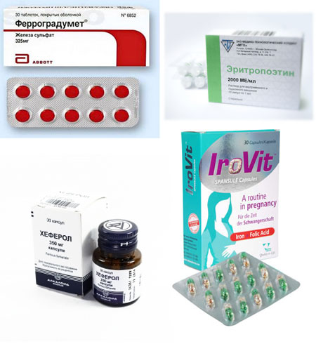 Як підвищити гемоглобін при вагітності