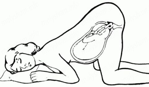 Позбавляємося від набряків при вагітності