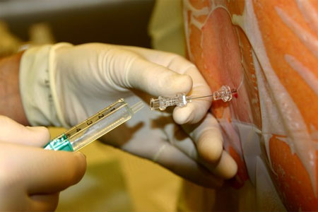 Показання до кесаревого розтину: вирок без оскарження або всього лише рекомендація?