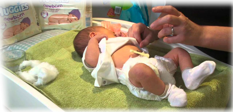 Що робити якщо у новонародженого гноїться пупок?