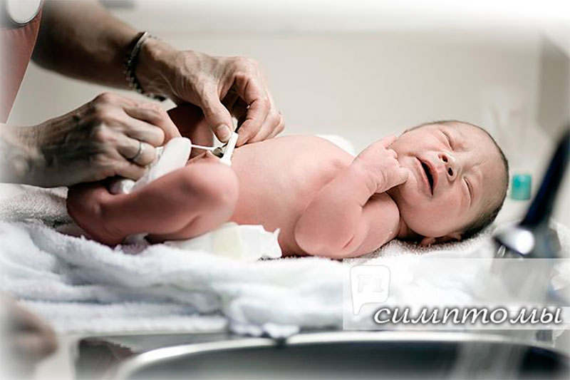 Що робити якщо у новонародженого гноїться пупок?