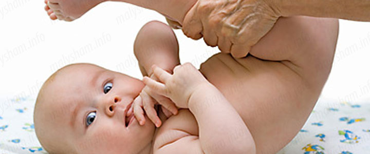 Гімнастика при пупкової грижі у дитини Гімнастика при пупкової грижі у дитини