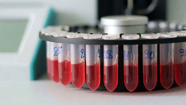 Розшифровка отриманих результатів