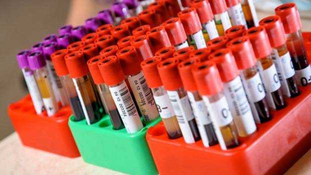 Гемостазіограмма при вагітності - для чого призначають