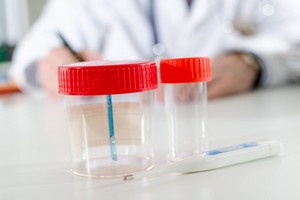 Аналіз сечі при вагітності