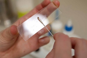 аналіз на ентеробіоз