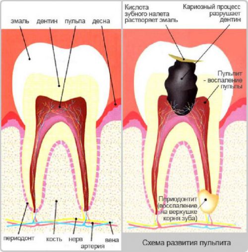 Лікування зубів при грудному вигодовуванні Лікування зубів при грудному вигодовуванні