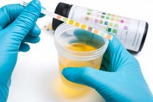 Причини появи лейкоцитів в сечі