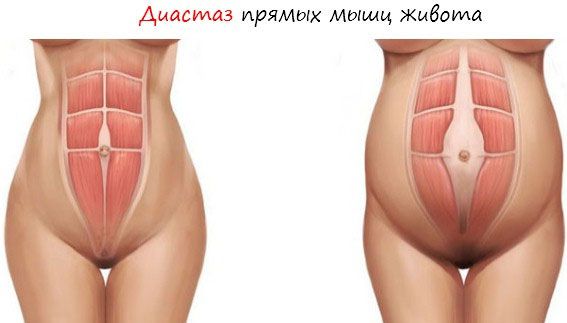 Як схуднути годуючій мамі