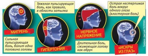 Таблетки від головного болю при грудному вигодовуванні Таблетки від головного болю при грудному вигодовуванні