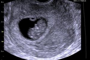 8 (восьмий) тиждень вагітності