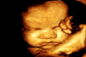 28 (двадцять восьмий) тиждень вагітності