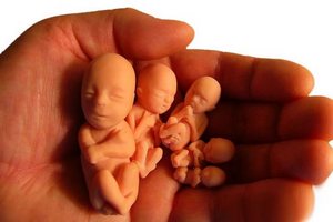 Невиношування вагітності - причини, симптоми, діагностика