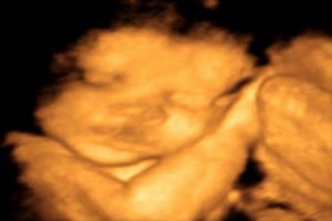 27 (двадцять сьомий) тиждень вагітності